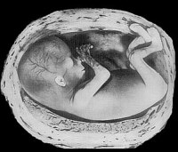 Menschlicher Fetus - (c) Bertelsmann, dva